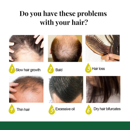 Ginger Care Hair Spray Hair Growth Essence Nourish Hair Roots Massag Scalp Repair Hair Quality Control Oil Hair Care Solution